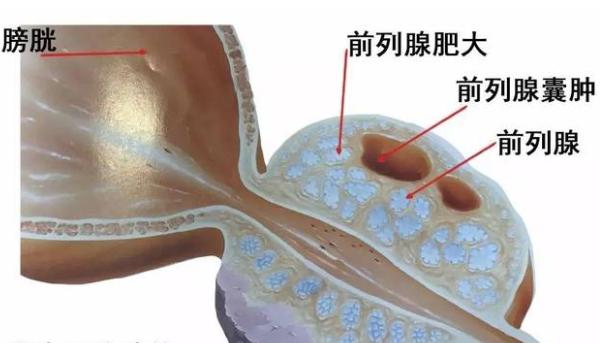 雄性犬为“良性前列腺增生症”风险种群,又该如何治疗和预防?