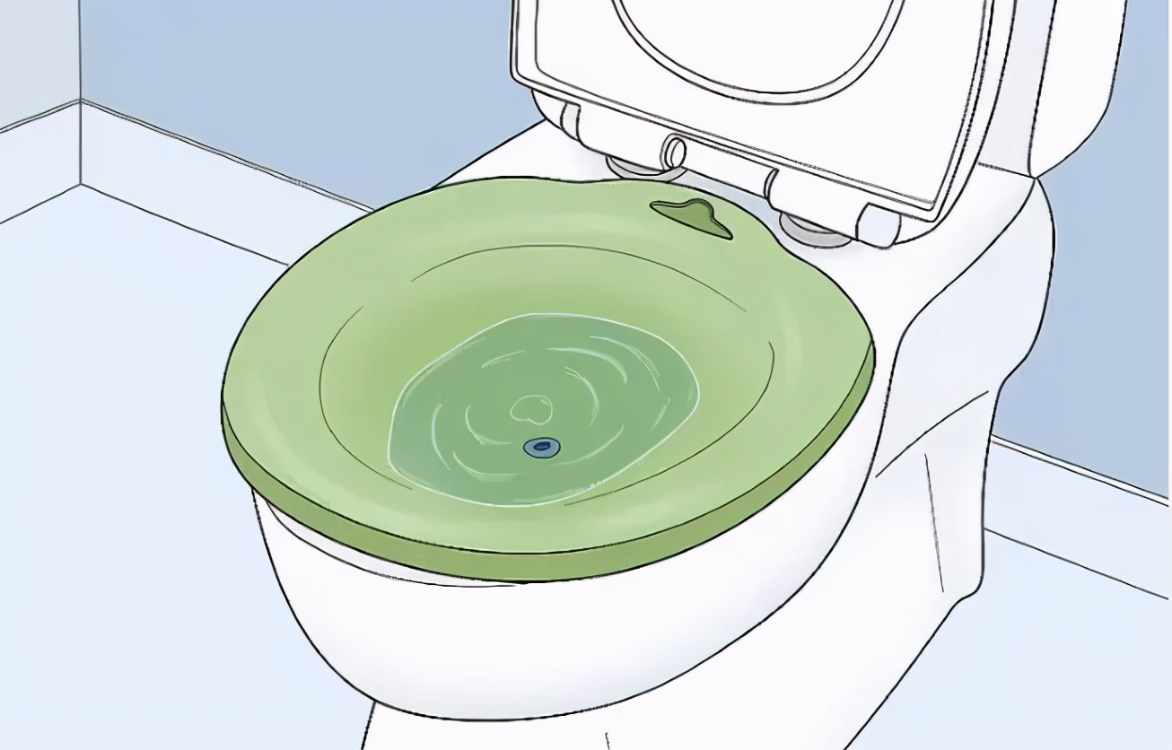 坐月子期间能去割痔疮吗,月子里割痔疮