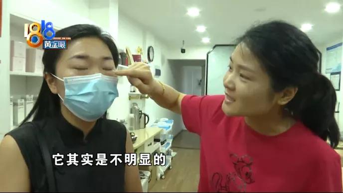 美瞳上有黑线正常吗,美瞳线做完有红血丝怎么回事