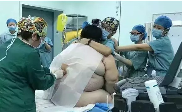 妇产科有男医生的意义到底是什么？如何保证是治病，而不是性侵