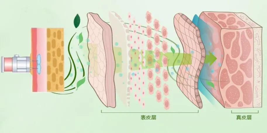 毛孔粗大指南,毛孔粗大四个小妙招