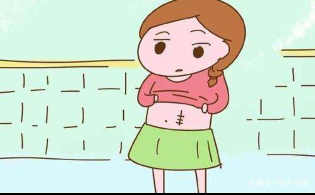 这几点剖腹产注意事项，希望可以帮您解决疑惑