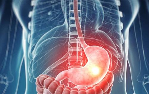 胃癌盆腔转移能治愈吗,怀疑盆腔炎复发要做什么检查