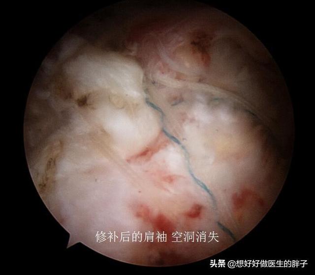 左肩疼痛是什么病的预兆,左肩疼痛要警惕什么病