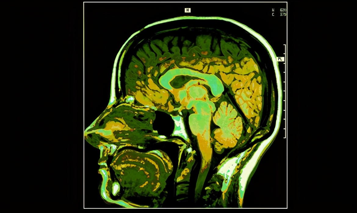 电击大脑实验,人性电击实验真实事件