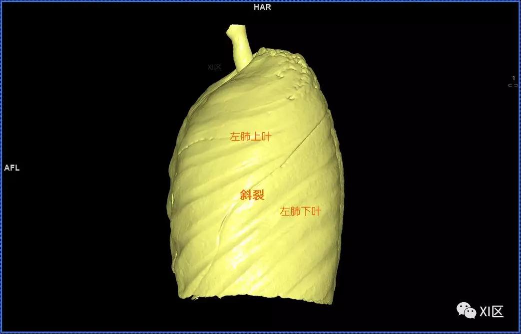如此详细的肺部影像解剖，有点儿酷