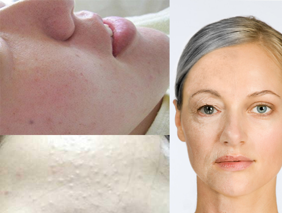 新西兰羊奶对比国内羊奶,为什么新西兰羊奶好