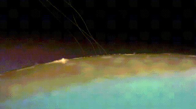 打孔埋线,一步搞定!马斯克的“赛博格”变身方案来了