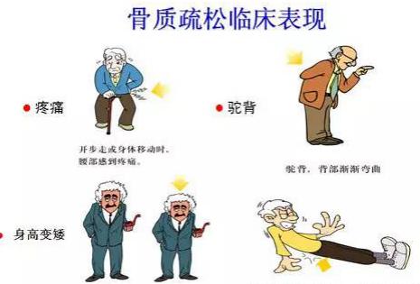 骨质疏松喝牛奶吃钙片有用吗,氨糖软骨素钙片对骨质疏松有用吗