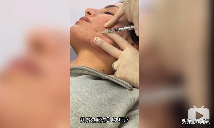 刘诗诗最近生图,刘诗诗旧照脸又胖又大