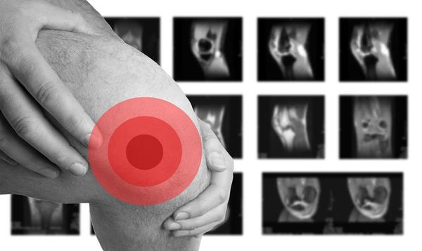 保护膝盖的锻炼方法有哪几种,膝盖退化的锻炼方法