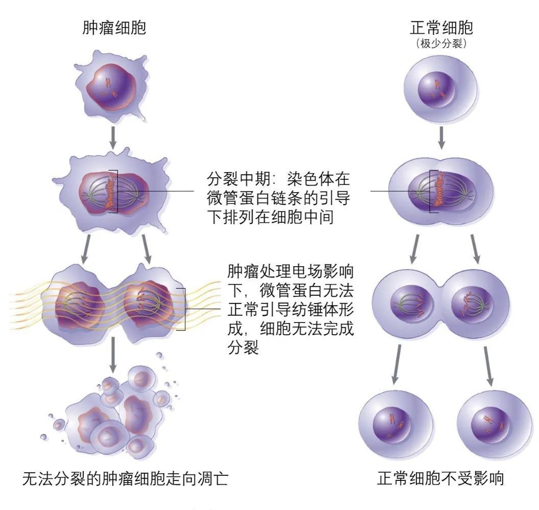 癌细胞电场疗法,内置电场杀死癌症细胞