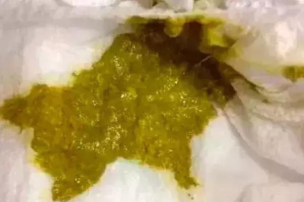 新手爸妈稳住！手把手教你看懂千姿百态大便便（超全观察指南）