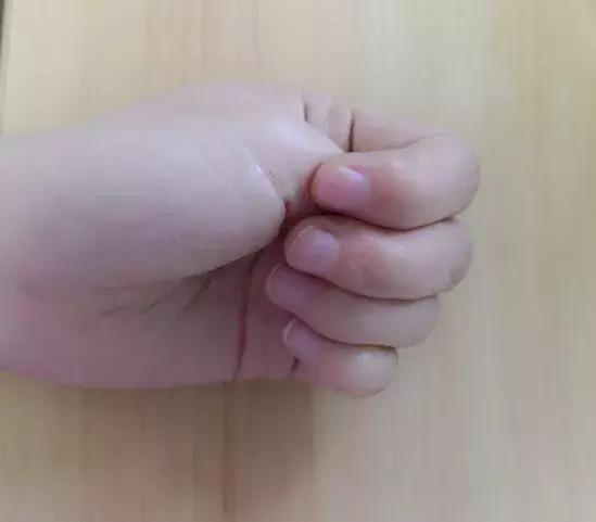 春夏两季湿气重该吃点什么,换季湿气太重了怎么排湿