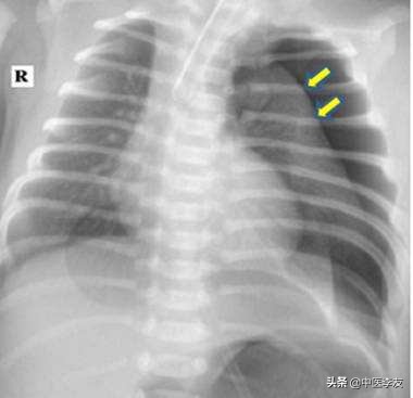 针灸学针刺的操作步骤和注意事项,学习针灸如何快速记住穴位