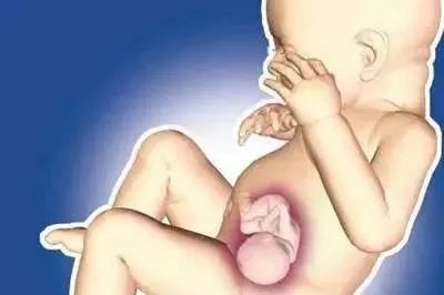 畸胎瘤为什么有毛骨头,51岁女子肚子里有畸胎瘤吗