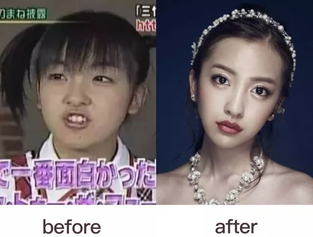 日本水原希子整容,水原希子真的整容了吗
