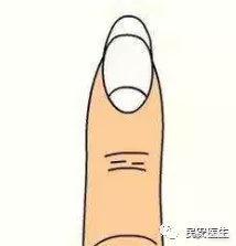 有关贫血的知识,看什么地方能知道贫血