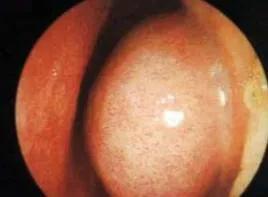 家中常备这6类儿童用药,家长们请注意儿童用药需谨慎