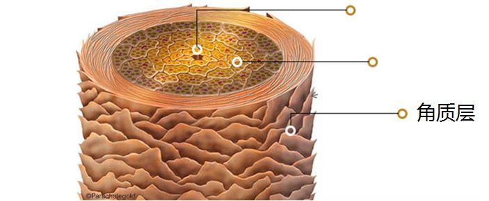 头发干枯分叉怎么护理,漂完头发干枯怎么护理