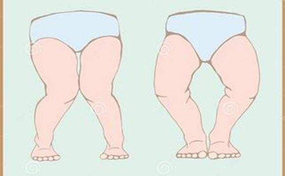 想要孩子长得好看怎么办,想要孩子长得好看要吃什么