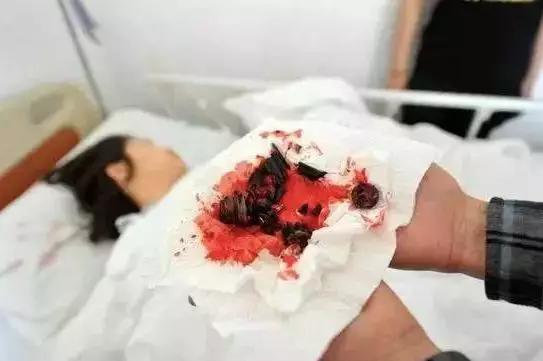 轻轻一坐，屁股炸得血肉模糊！年年有人被椅子炸飞，赶紧自查