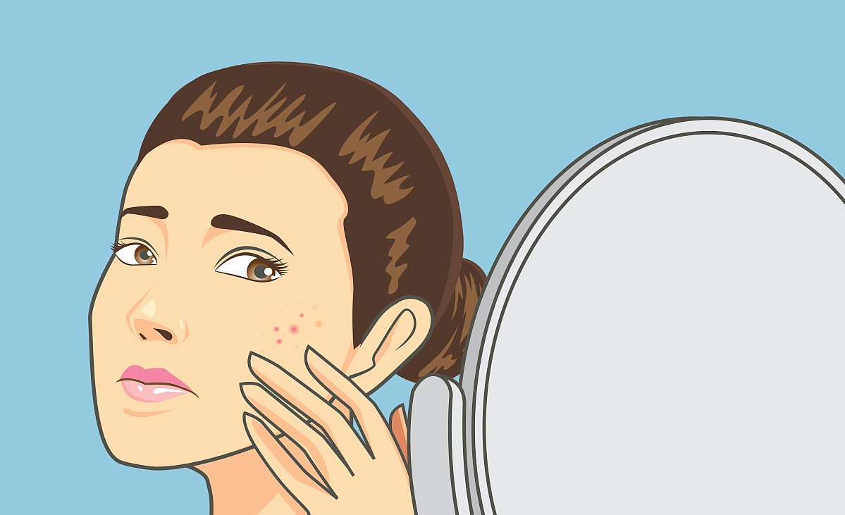 怎么治疗激素皮炎毛细血管扩张,激素依赖性皮炎治好了皮肤还红吗