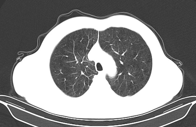 医生解读ct有差异吗,医生是怎么看懂ct的