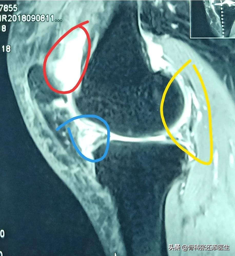 花椒泡水喝治什么病最有效,辟谣花椒功效