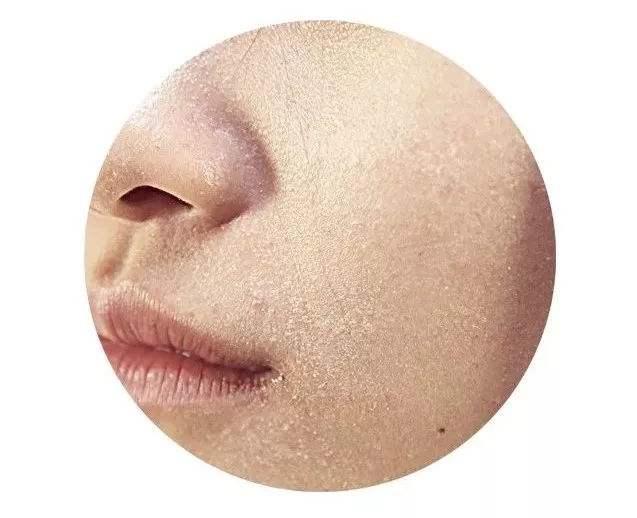 30岁皮肤暗沉用什么牌子的护肤品,各种皮肤适合哪种护肤品讲解