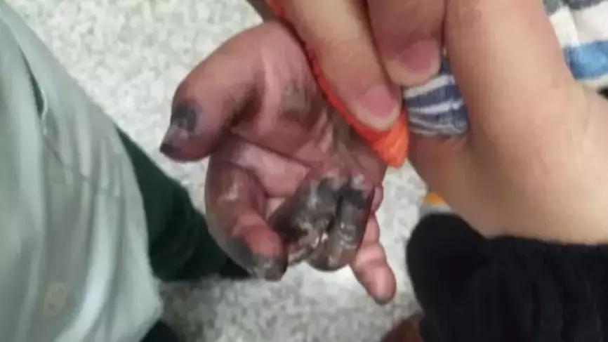 电动车充电口会有火花影响电瓶吗,电动车充电时会不会电人