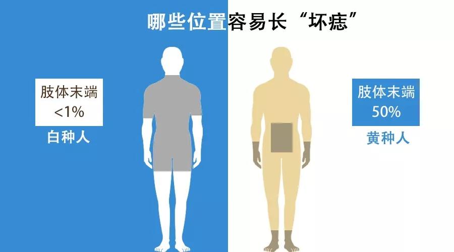 小心直径大于6毫米的痣