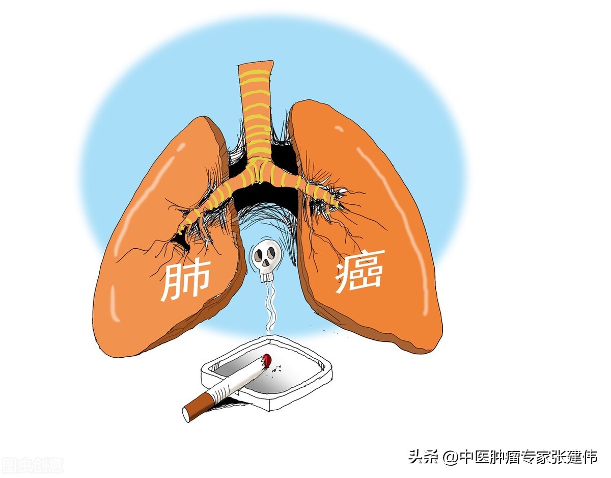 肺癌患者健身运动,肺癌患者可以运动吗