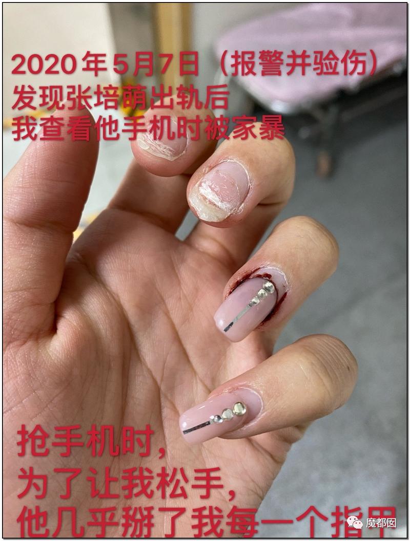 短跑名将张培萌被曝家暴反转,短跑名将张培萌家暴背后