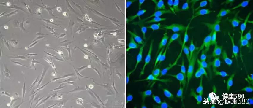 间充质干细胞哪些医院有,间充质干细胞质量指标