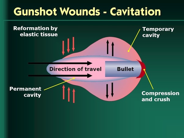 人体一旦被子弹击中后会怎样,被麻醉弹击中会怎样