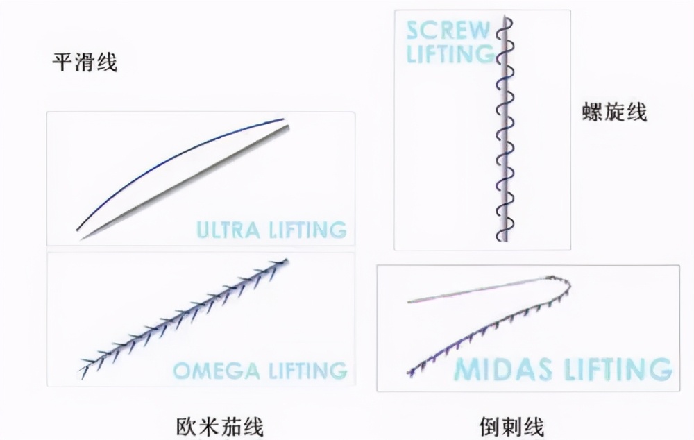 无针逆龄线雕全脸抗衰,抗衰线雕怎么做