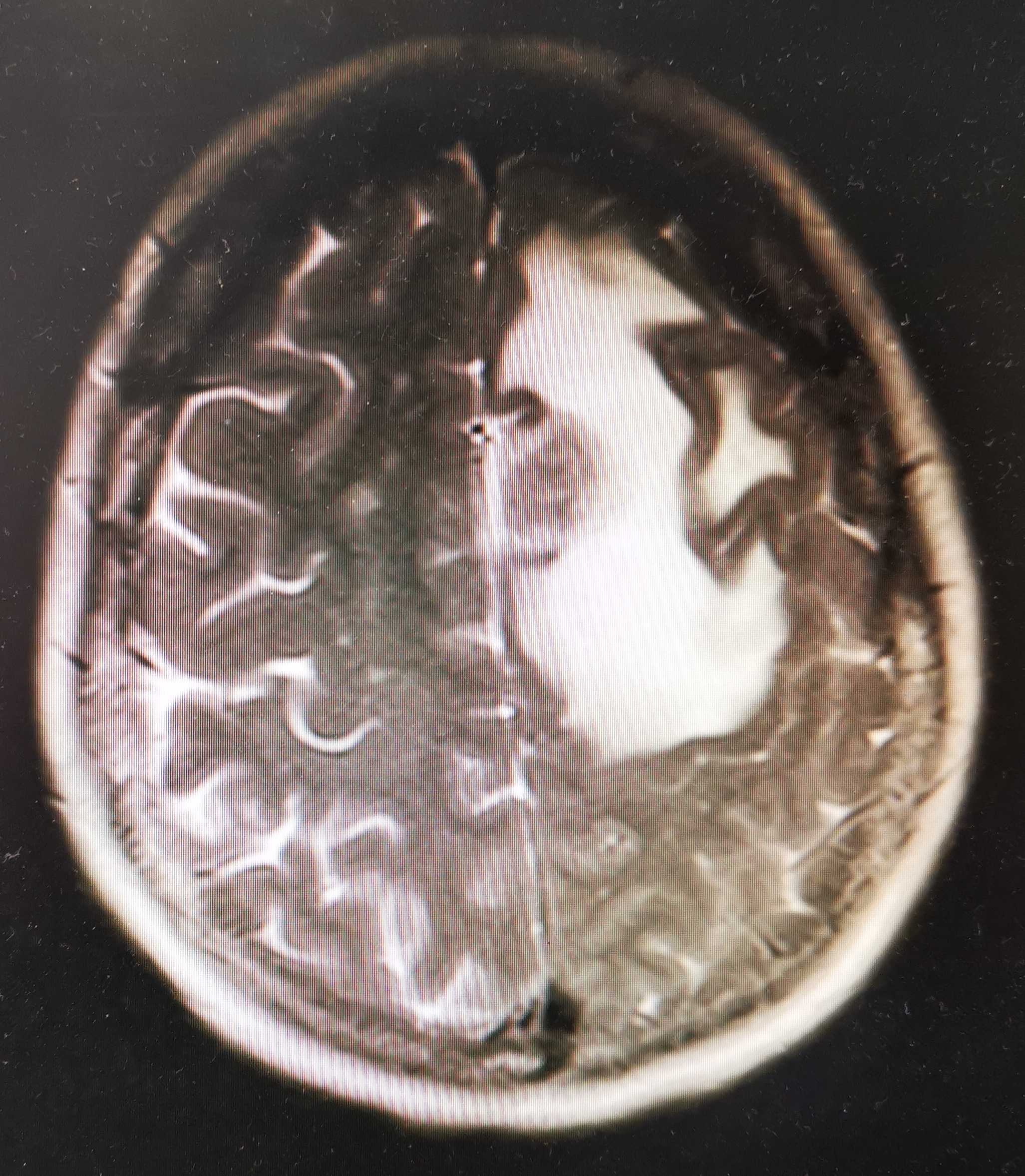 一个癌症患者的自我剖析,一个肿瘤外科医生的反思