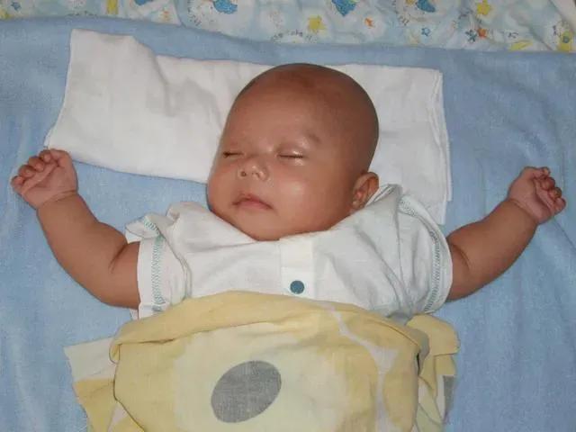 如何预防孩子扁头,怎么预防婴儿睡扁头