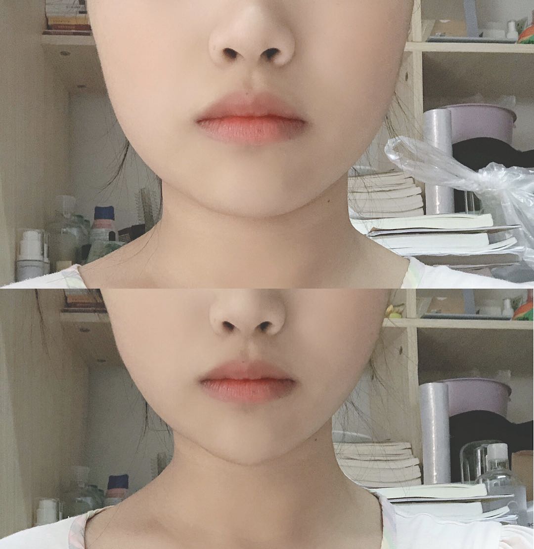 精油瘦脸法让你快速瘦脸成功