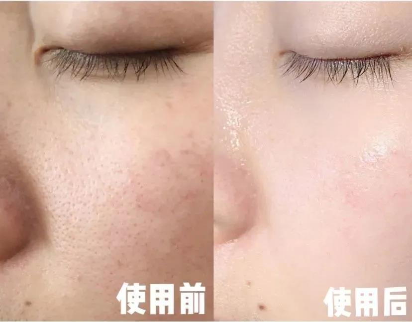 空调房皮肤干燥痒怎么快速解决,屋里干燥皮肤痒