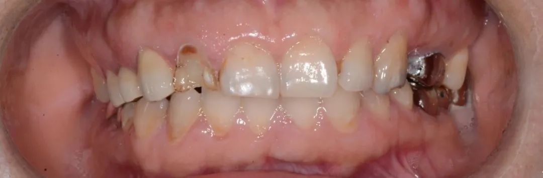 口腔牙医感言,牙医从业感悟