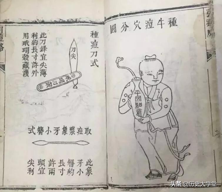 在中国天花是怎么被解决的,历史上的天花是怎么消灭的