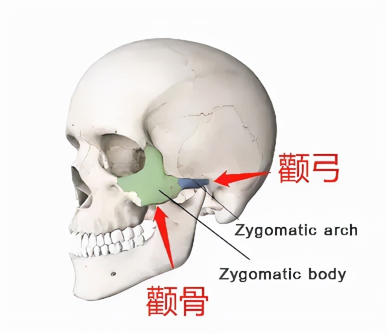 韦敏颧骨手术怎么样,如何判断高颧骨和颧弓外扩
