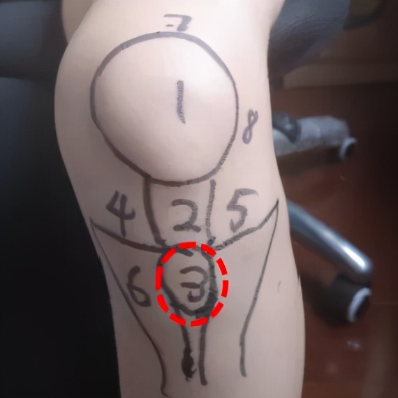 膝盖痛12种疼痛对照表图解,不同部位膝盖疼痛的原因