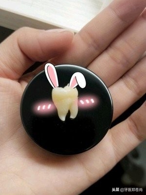 拔完智齿拆线后多久可以正常吃饭,拔完智齿后能不能吃饭