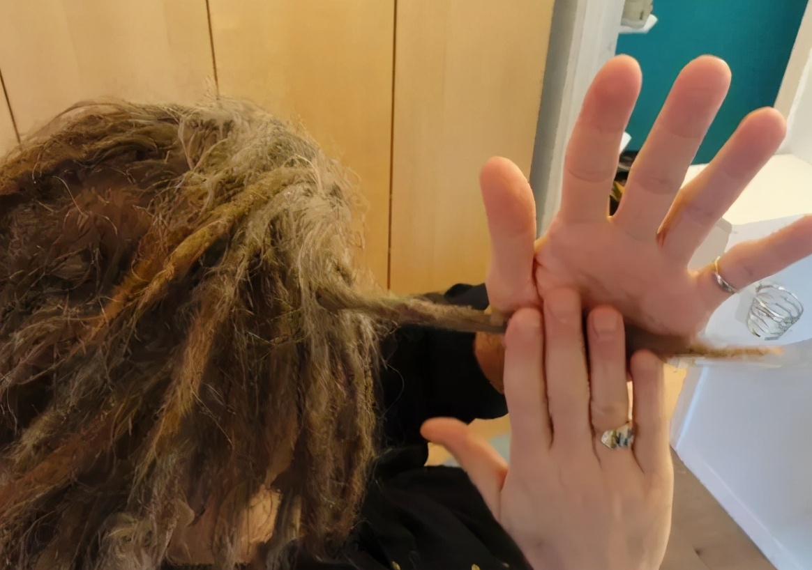 狐臭是一种生理现象么,狐臭是什么病引起的