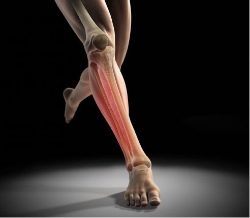 跑者小腿疼痛如何解决,初跑者小腿酸痛如何正确的跑步