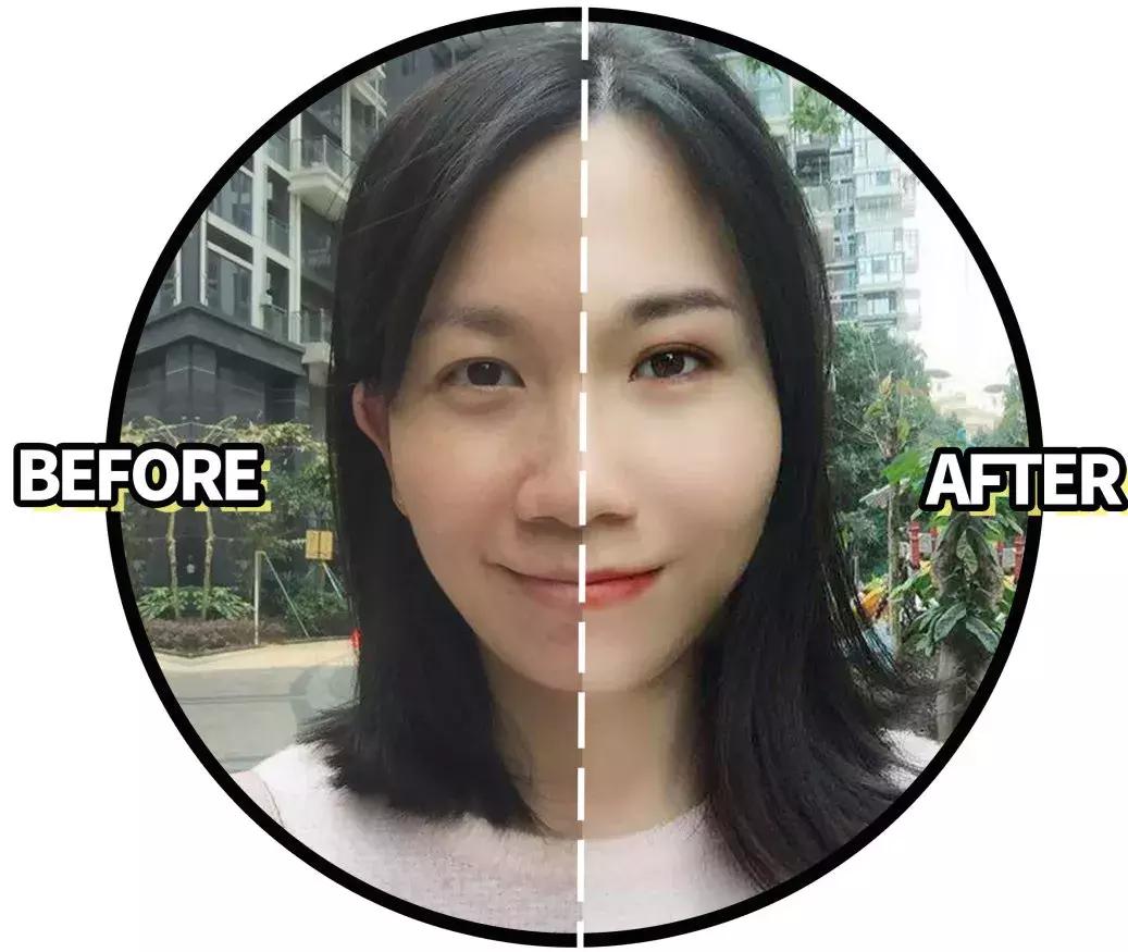 蒜头鼻怎么才能修成精致小翘鼻,如何让自己的蒜头鼻变成小巧鼻