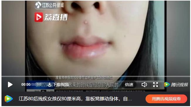 挤痘进入icu,随手挤了个痘痘